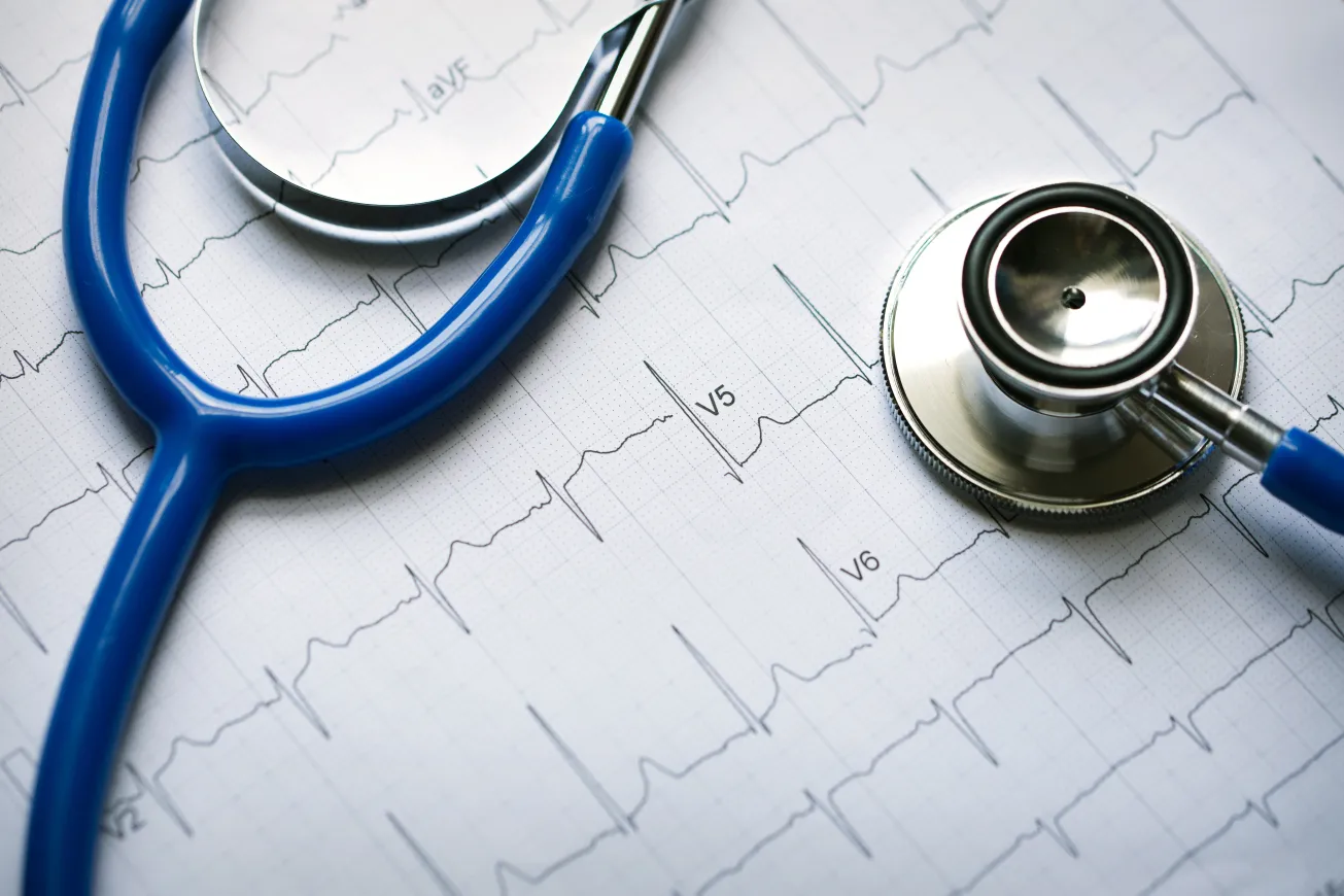 Stethoscope on top of EKG