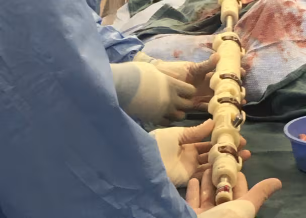 doctors in surgery