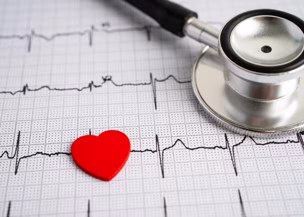 Stethoscope on top of EKG