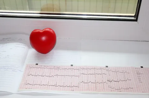 heart rhythm chart