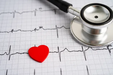 Stethoscope on top of EKG