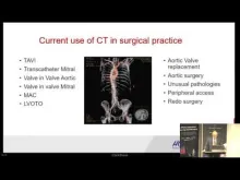 Embedded thumbnail for Healthy Heart Valves