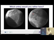 Embedded thumbnail for Heart Attacks, Blockages &amp; Stents: Why &amp; How You Should Care for Your Coronary Arteries for a Healthier Heart