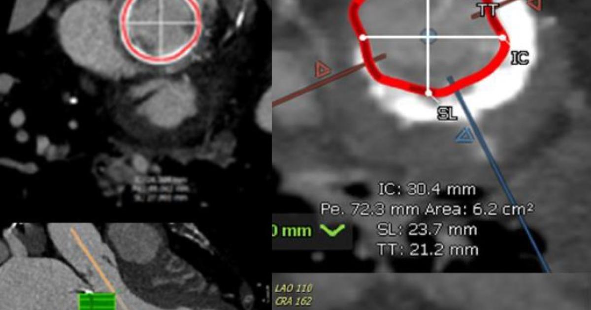 Mvr Radiograph Training Professionals Across the Globe in the Latest Techniques for ...