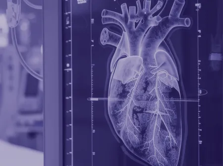 An image depicting a CT scan of the heart