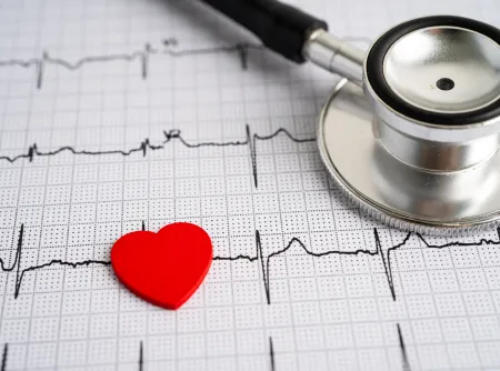 Stethoscope on top of EKG